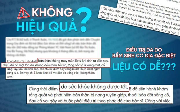 “Không có kết quả hay không đủ kiên nhẫn?”- Thực hư kết quả khi điều trị bệnh lý về da